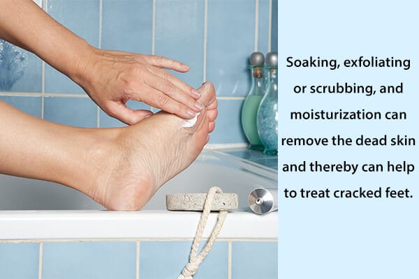 Cracked feet: home remedies, medical 