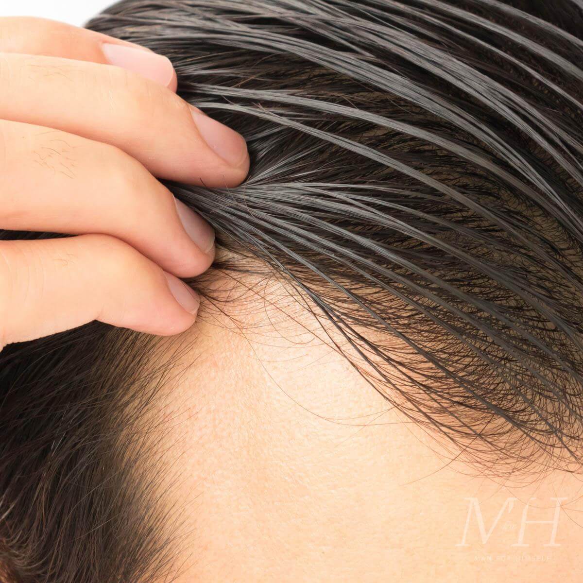 علاجات الشعر الدهني: 7 طرق سهلة للتخلص من الشعر الدهني - %categories