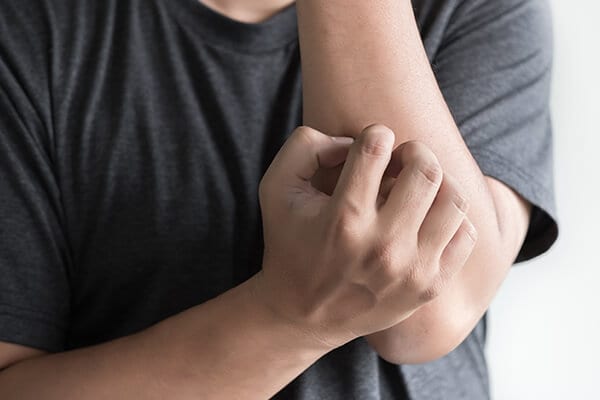 Coudes squameux et secs : 6 remèdes maison, causes, symptômes et astuces - skin-beauty Symptômes - Coudes croustillants et secs : 6 remèdes maison, causes, symptômes et conseils