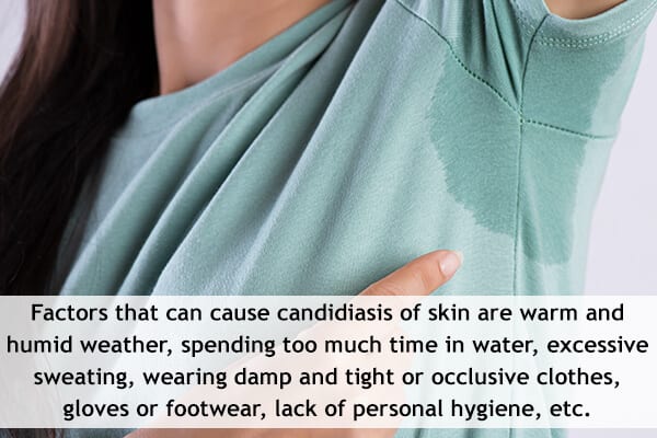 ما هو داء المبيضات الجلدي وكيف يتم علاجه - %categories
