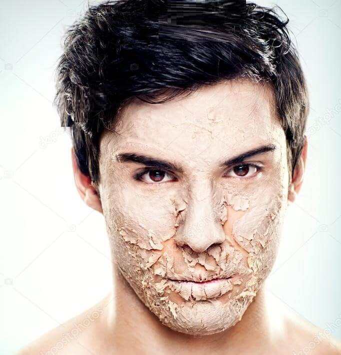 كيفية علاج تقشر بشرة الوجه - skin-beauty depositphotos 25283675 stock photo peeling skin - كيفية علاج تقشر بشرة الوجه