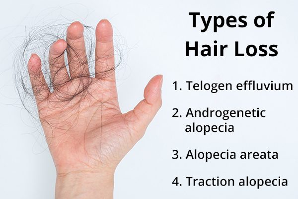 5 أسباب شائعة لتساقط الشعر وكيفية علاجه - %categories