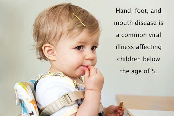 10 أمراض معدية شائعة خلال فترة الطفولة وكيفية علاجها - %categories