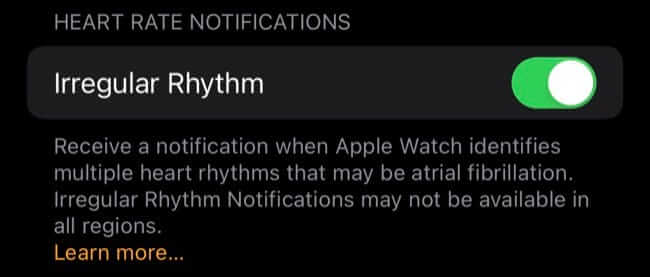 irregular_rhythm-650x277 12 نصيحة للاستفادة القصوى من ساعة Apple Watch الجديدة