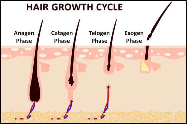 تساقط الشعر: الأسباب ، أنواعه ، والعلاج - %categories