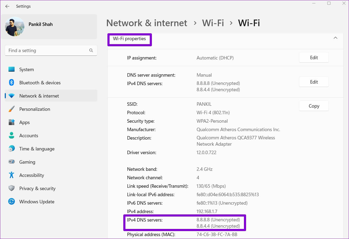 Wi-Fi-Properties-on-Windows-11-1319x904 أفضل 3 طرق لتغيير خادم DNS على Windows 11