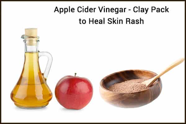 6 طرق لاستخدام خل التفاح لعلاج الطفح الجلدي - skin-beauty apple cider vinegar and clay to heal a skin rash 600x400 - 6 طرق لاستخدام خل التفاح لعلاج الطفح الجلدي