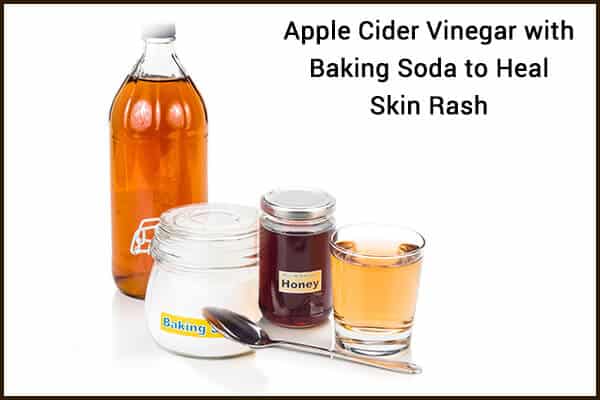 6 طرق لاستخدام خل التفاح لعلاج الطفح الجلدي - skin-beauty apple cider vinegar baking soda to heal a skin rash 600x400 - 6 طرق لاستخدام خل التفاح لعلاج الطفح الجلدي