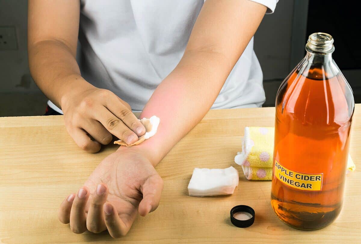 6 طرق لاستخدام خل التفاح لعلاج الطفح الجلدي - skin-beauty apple cider vinegar to heal a skin rash feat 1200x811 - 6 طرق لاستخدام خل التفاح لعلاج الطفح الجلدي
