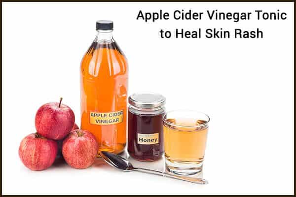 6 طرق لاستخدام خل التفاح لعلاج الطفح الجلدي - skin-beauty apple cider vinegar tonic to heal a skin rash 600x400 - 6 طرق لاستخدام خل التفاح لعلاج الطفح الجلدي