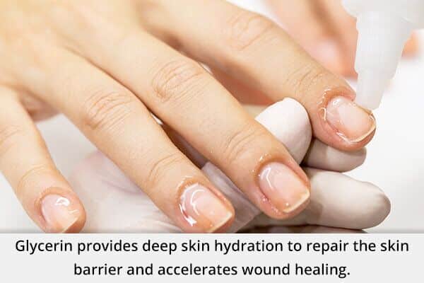 5 علاجات منزلية لتقشر الجلد حول الأظافر - %categories