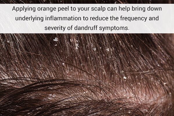 10 استخدامات مذهلة لقشر البرتقال وكيفية تخزينه - skin-beauty orange peels may help to control dandruff 600x400 - 10 استخدامات مذهلة لقشر البرتقال وكيفية تخزينه