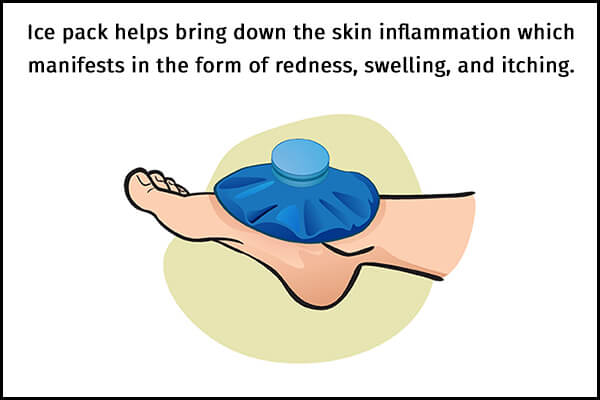 علاج لسعات قنديل البحر - skin-beauty ice pack helps to manage jellyfish stings 600x400 - علاج لسعات قنديل البحر