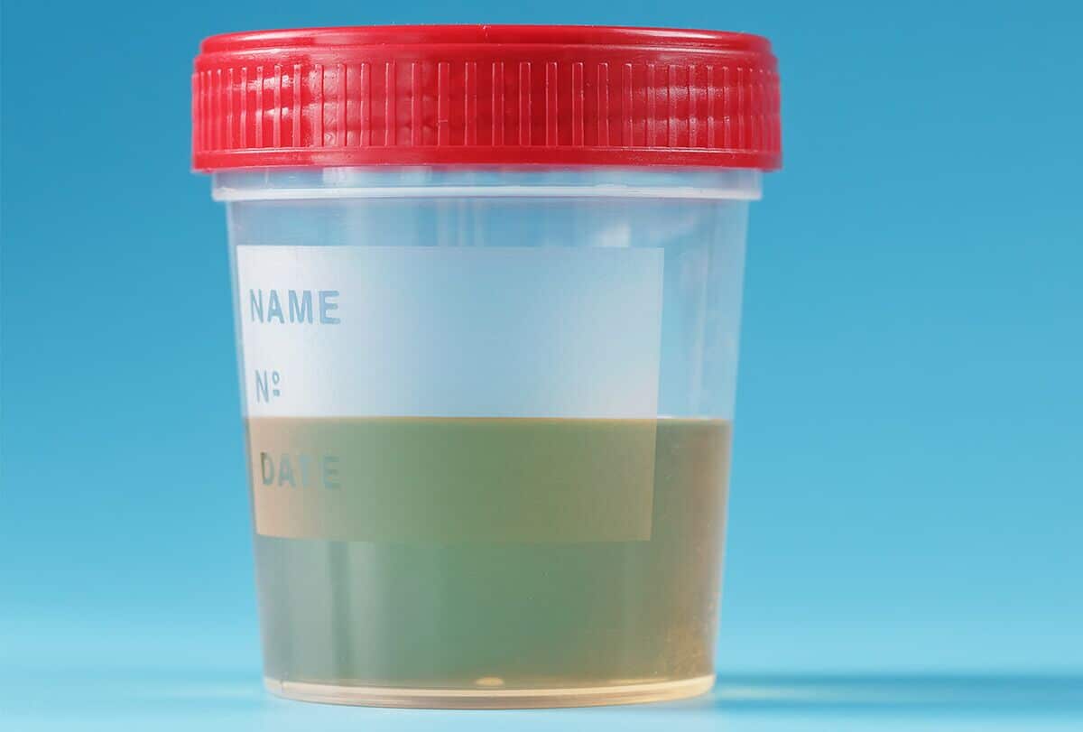 ماذا يشير لون البول حول صحتك - urinary-tract-health know what your urine color tells about your health feat 1200x811 - ماذا يشير لون البول حول صحتك