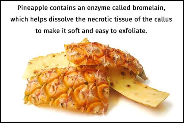 طرق طبيعية لإزالة نسيج مسمار اللحم في المنزل - skin-beauty pineapple peel to manage calluses 600x400 - طرق طبيعية لإزالة نسيج مسمار اللحم في المنزل