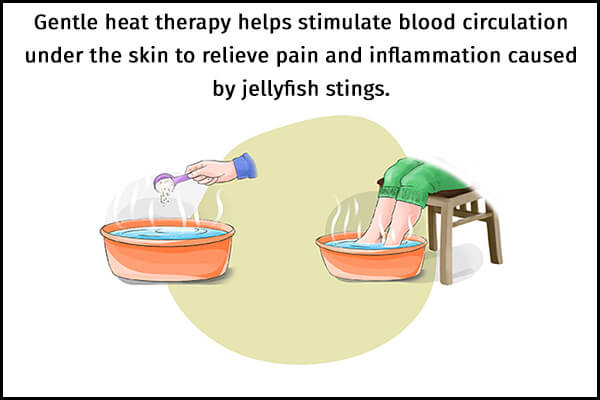 علاج لسعات قنديل البحر - skin-beauty soak in hot water helps to manage jellyfish stings 600x400 - علاج لسعات قنديل البحر