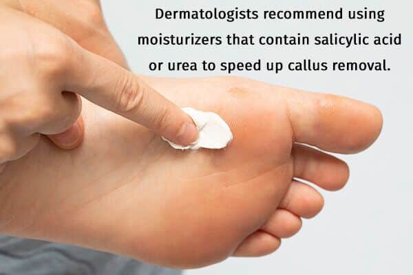 طرق طبيعية لإزالة نسيج مسمار اللحم في المنزل - skin-beauty steps to remove calluses moisturize 600x400 - طرق طبيعية لإزالة نسيج مسمار اللحم في المنزل