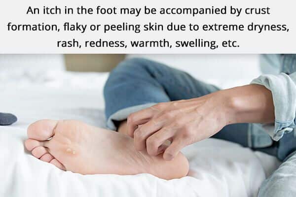 symptoms of itchy feet 600x400 - حكة القدمين: الأسباب والأعراض والعلاج