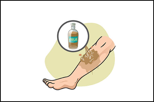 علاج لسعات قنديل البحر - skin-beauty vinegar helps to manage jellyfish stings 600x400 - علاج لسعات قنديل البحر