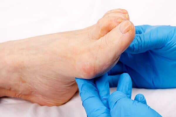 when to see a doctor for itchy feet 600x400 - حكة القدمين: الأسباب والأعراض والعلاج