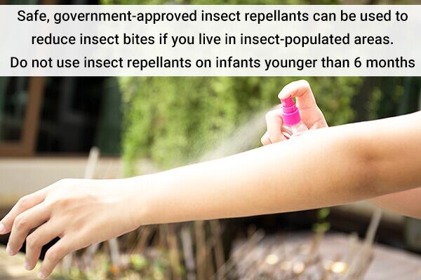10 علاجات منزلية سهلة تورم لدغات الحشرات - %categories