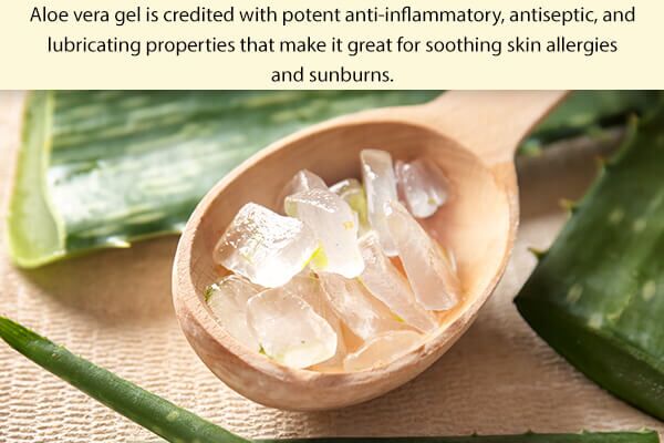 your-natural-first-aid-kit-should-contain-aloe-vera-gel-600x400 كيفة تحضير مجموعة الإسعافات الأولية الطبيعية