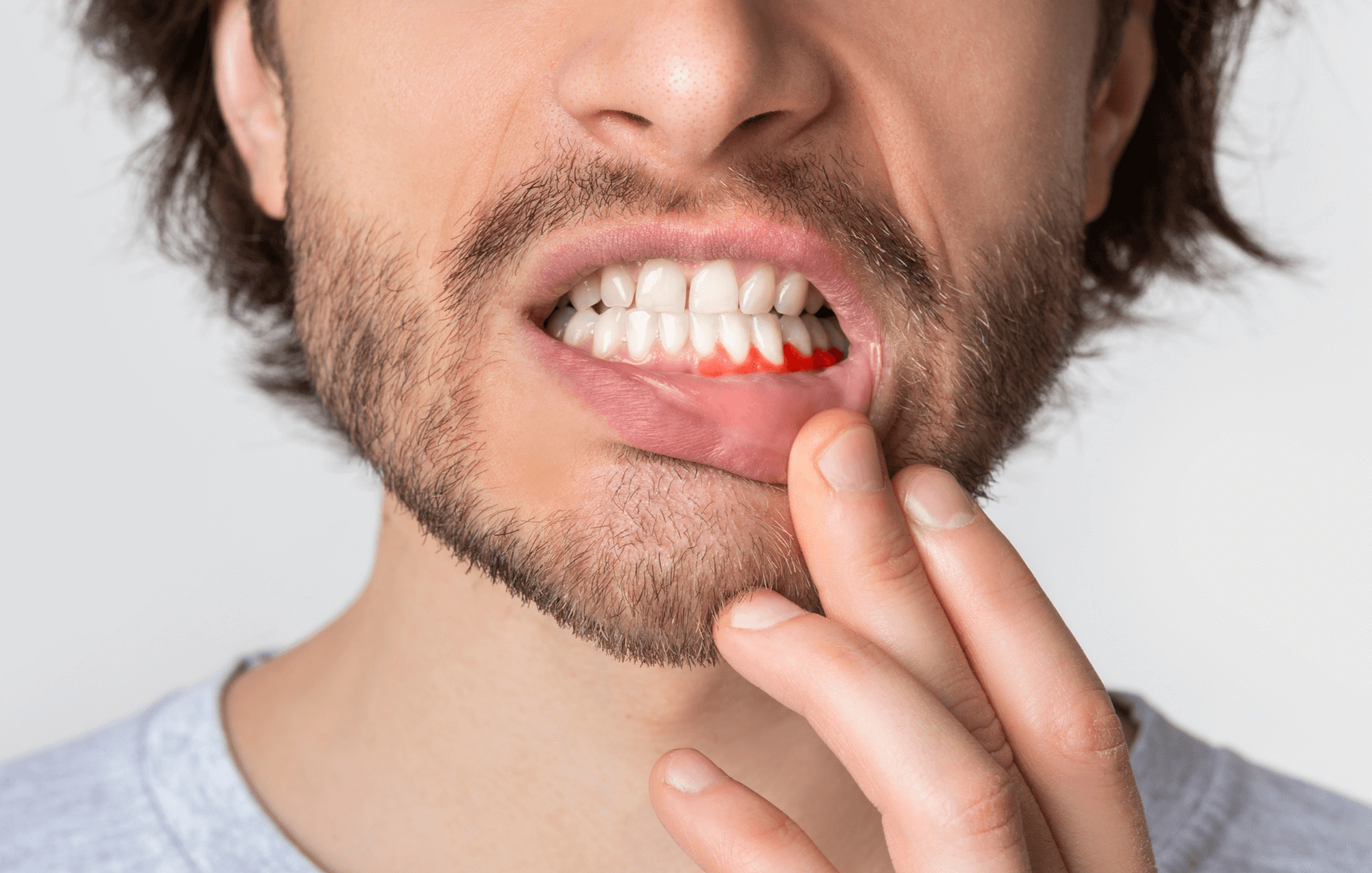 انحسار اللثة: العلاج والأسباب والأعراض وعوامل الخطر - oral-health Northumberland Dental Care receding gums - انحسار اللثة: العلاج والأسباب والأعراض وعوامل الخطر