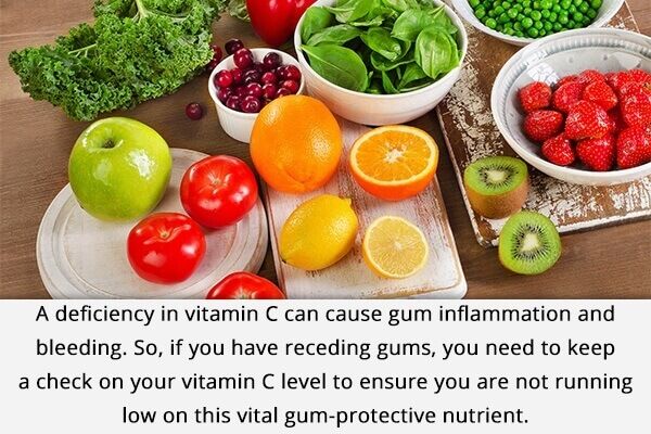 10 علاجات منزلية لانحسار اللثة - oral-health up your vitamin c intake for receding gums 600x400 - 10 علاجات منزلية لانحسار اللثة