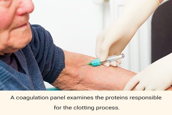 coagulation-panel-simple-blood-tests-600x400 10 فحوصات دم مهمة يمكنها اكتشاف الأمراض والحالات المرضية