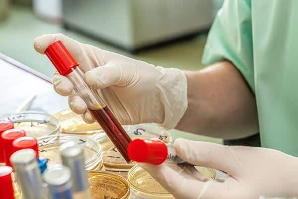 general-queries-blood-tests-600x400 10 فحوصات دم مهمة يمكنها اكتشاف الأمراض والحالات المرضية
