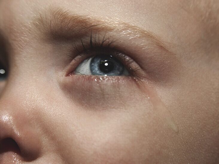 Ağlamaktan dolayı şişmiş gözler: Şişliği azaltmak için 8 tedavi - %kategoriler