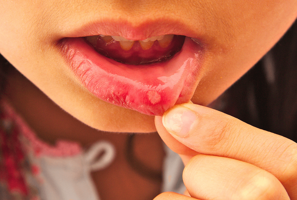 لماذا تعتبر صحة الفم الجيدة مهمة جدًا لمرضى السكر - oral-health good oral health is important for diabetics feat - لماذا تعتبر صحة الفم الجيدة مهمة جدًا لمرضى السكر