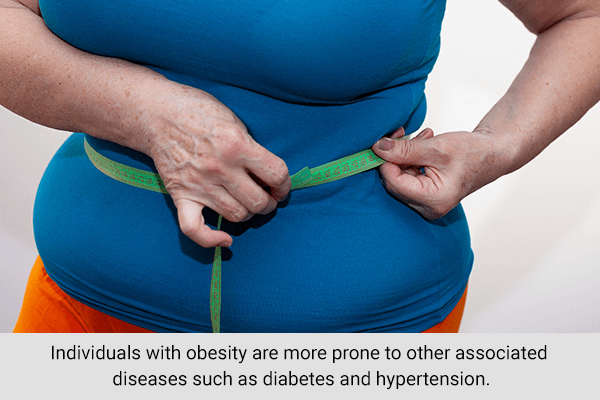 may-reduce-obesity-health-benefits-of-sunlight 9 فوائد صحية من التعرض لأشعة الشمس باعتدال