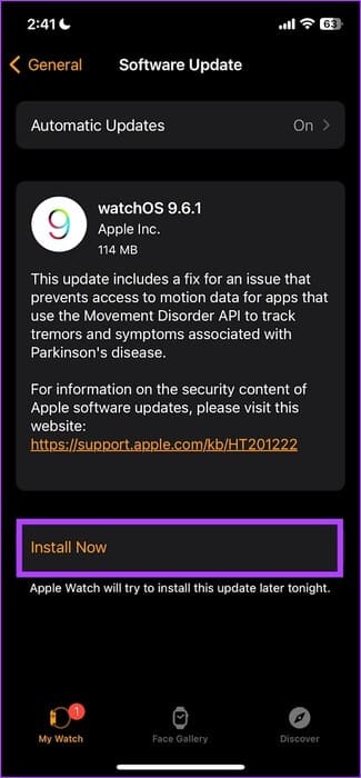 Install-Now 11 طريقة لإصلاح عدم عمل Siri على Apple Watch