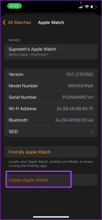 Unpair-Apple-Watch كيفية تعطيل وقت التوقف على Apple Watch
