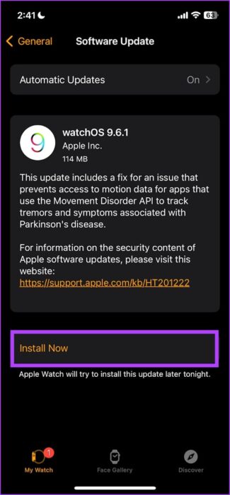 Install-Now-1-e1704064880131 12 طريقة لإصلاح عدم عمل الميكروفون على Apple Watch