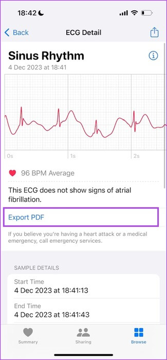 كيفية إعداد واستخدام تخطيط القلب (ECG) على Apple Watch - %categories