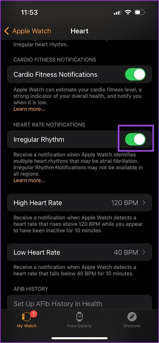 كيفية إعداد واستخدام تخطيط القلب (ECG) على Apple Watch - %categories