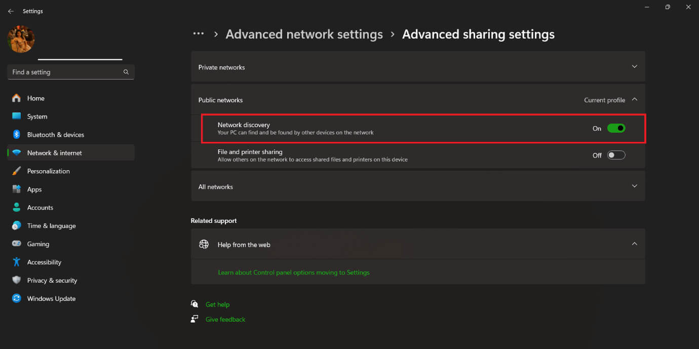 toggle-on-network-discovery كيفية تغيير NAT Type 3 إلى 2 على PS4 وPS5 وXbox One